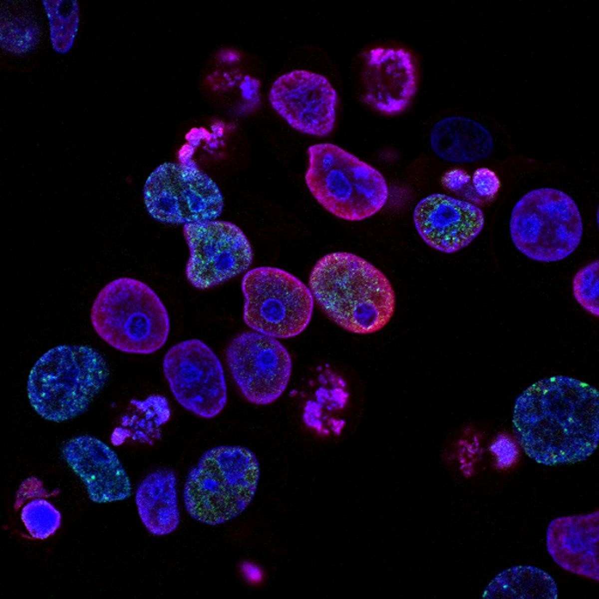 Fluorescent microscopy of living cells — proteins and genetic material at work